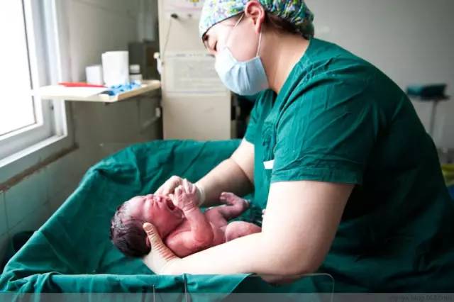 剖腹产全景记录,剖腹产恢复不同时期的照片