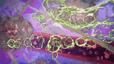 美容利器，竟然也是癌症帮凶！这帮科学家靠消灭体内玻尿酸治疗癌症，一日拿下20亿美元订单｜奇点实力派