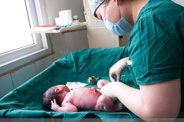 剖腹产全景记录,剖腹产恢复不同时期的照片