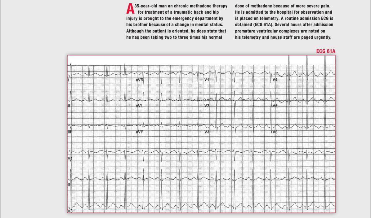 读心有术讲的是什么,读心有术