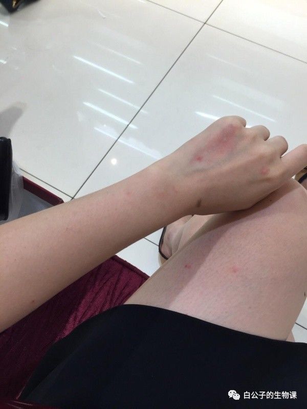 狗狗养护知识如何防止对狗狗过敏,对狗狗过敏的症状及治疗方法