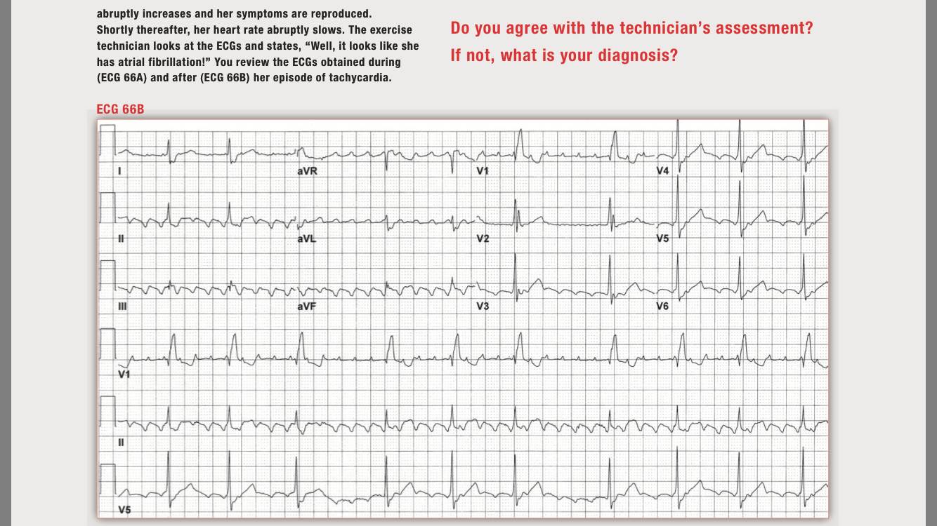 读心有术216,读心有术236期