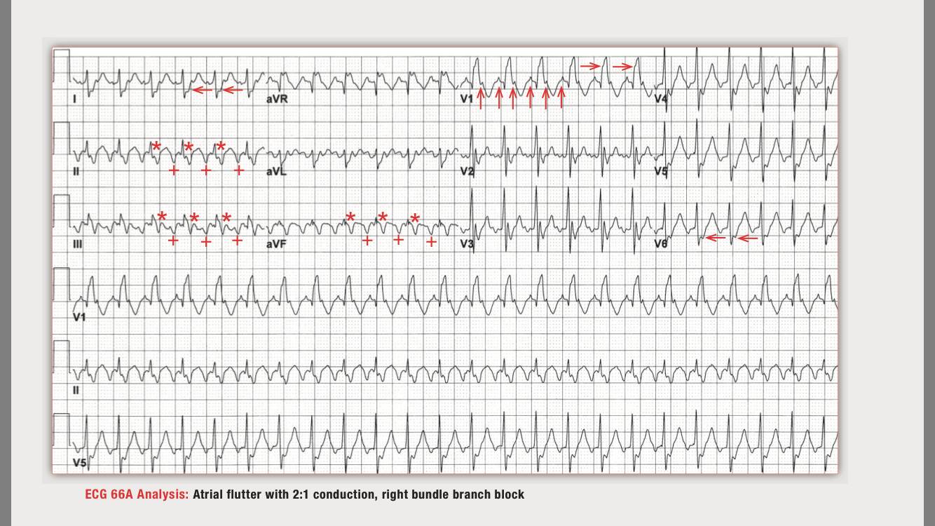 读心有术216,读心有术236期