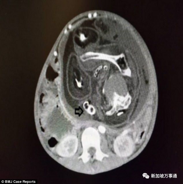 <html>
<head><title>502BadGateway</title></head>
<body>
<center><h1>502BadGateway</h1></center>
<hr><center>nginx</center>
</body>
</html>
<!--apaddingtodisableMSIEandChromefriendlyerrorpage-->
<!--apaddingtodisableMSIEandChromefriendlyerrorpage-->
<!--apaddingtodisableMSIEandChromefriendlyerrorpage-->
<!--apaddingtodisableMSIEandChromefriendlyerrorpage-->
<!--apaddingtodisableMSIEandChromefriendlyerrorpage-->
<!--apaddingtodisableMSIEandChromefriendlyerrorpage-->
