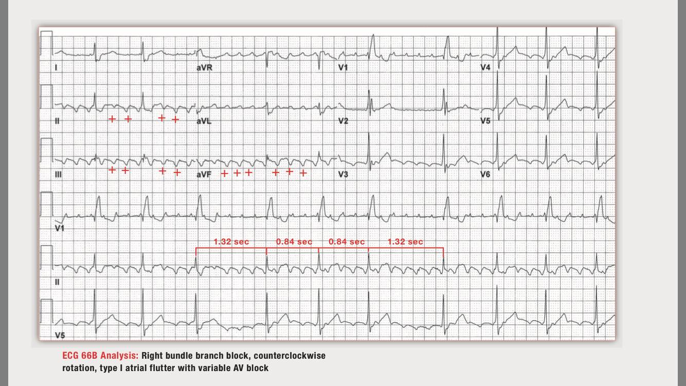 读心有术216,读心有术236期