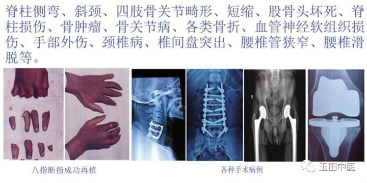 北京骨科扭伤中医专家,北京骨伤医院骨科专家