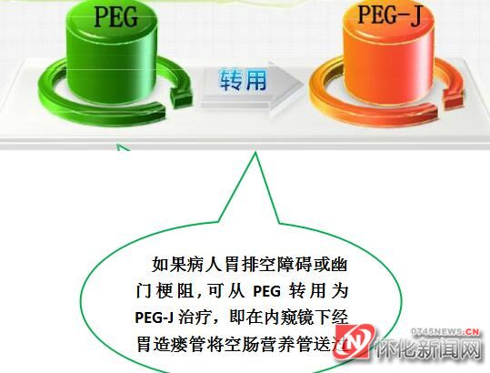 湖南医药学院第一附属医院成功为一气管食管瘘危重患者实施微创治疗