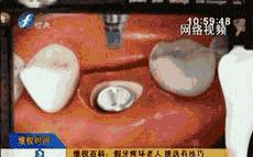 做假牙不合适怎么维权,假牙质量不好如何维权