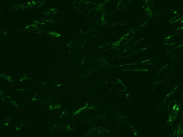 微整形安全与风险解析,脸部微整形有什么风险