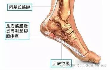 后足跟痛怎么跑步,脚再痛也要坚持