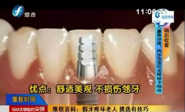 做假牙不合适怎么维权,假牙质量不好如何维权