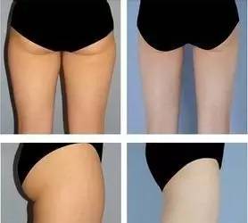 「杏林微科普」您的“尊臀”还好吗?