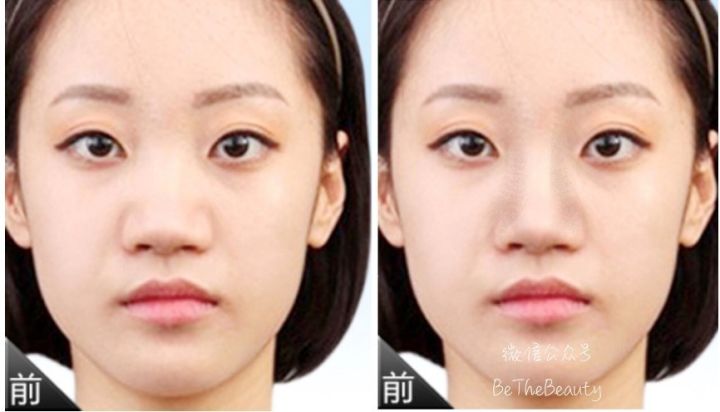 鼻翼宽鼻头大怎么办,塌鼻子鼻翼宽妆容