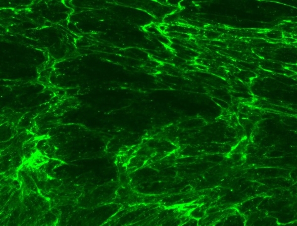 微整形安全与风险解析,脸部微整形有什么风险