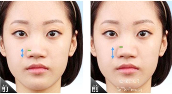 鼻翼宽鼻头大怎么办,塌鼻子鼻翼宽妆容