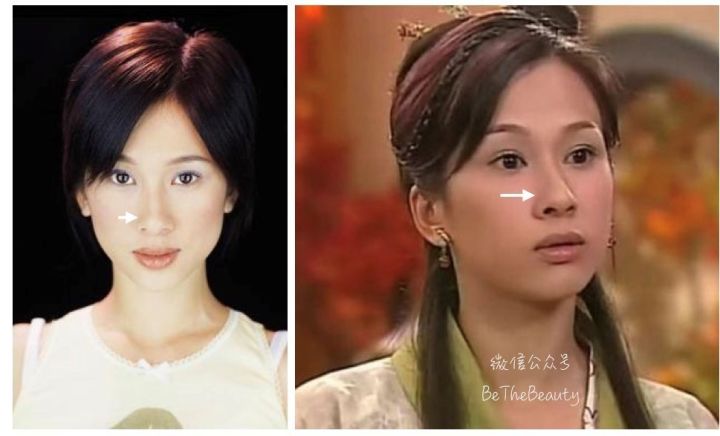 鼻翼宽鼻头大怎么办,塌鼻子鼻翼宽妆容