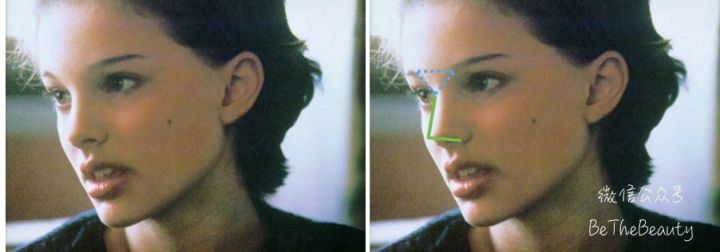 鼻翼宽鼻头大怎么办,塌鼻子鼻翼宽妆容