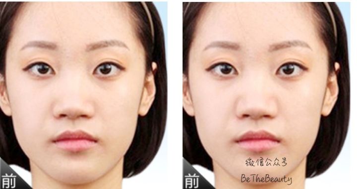 鼻翼宽鼻头大怎么办,塌鼻子鼻翼宽妆容