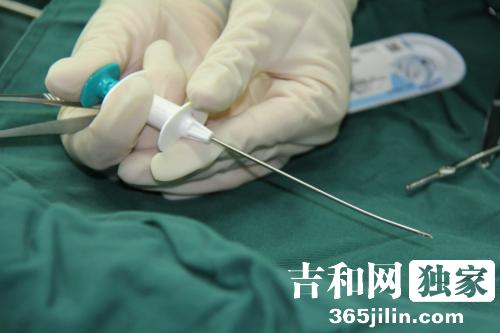 长春市哪家医院看儿童疝气好,长春哪个医院小孩疝气做的好