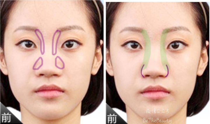鼻翼宽鼻头大怎么办,塌鼻子鼻翼宽妆容