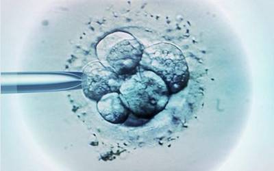 重庆医学界又出大新闻,谁说白内障青光眼不可逆……