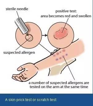 过敏性鼻炎药师和病患对话,过敏性鼻炎问诊对话