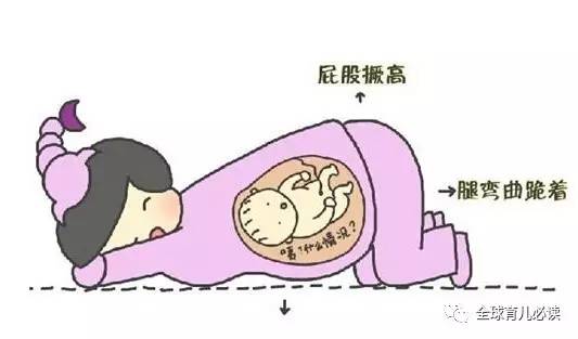 胎位不正婆婆让顺产,顺产胎位不正压肚子