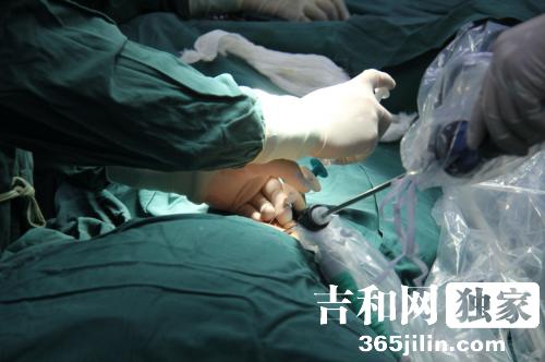 长春市哪家医院看儿童疝气好,长春哪个医院小孩疝气做的好