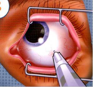 黄斑病变的克星,得了黄斑病变需要忌什么食物