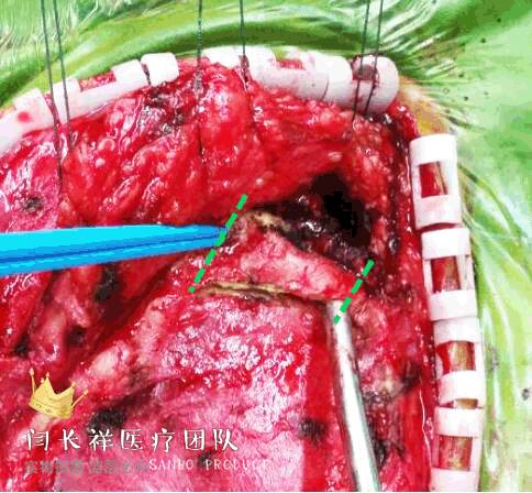 烦人的耳鸣,烦人耳鸣