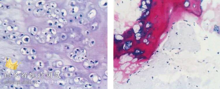 烦人的耳鸣,烦人耳鸣