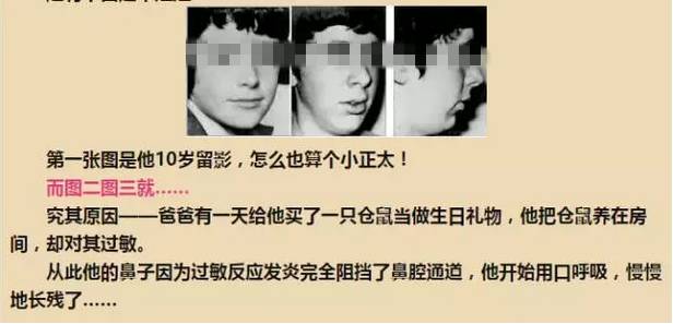 小小年纪竟然得了鼻炎,小小年纪鼻炎