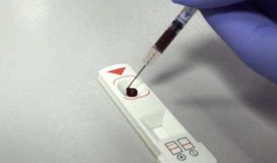 心肌酶升高一定会发生心梗吗,心肌酶升高会引起什么病