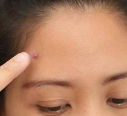 秋天嘴皮干燥起皮什么原因,秋天皮肤干燥起皮用什么护肤品