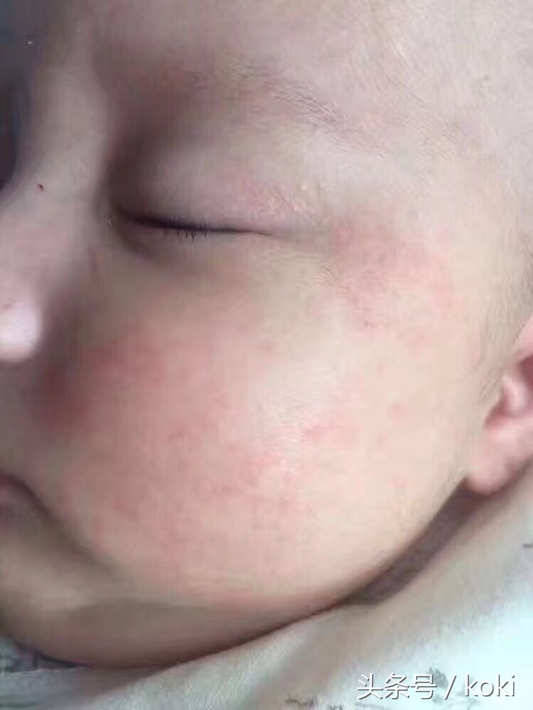 如果你是干性、中性、敏感性肌肤,脸上容易有表情纹、干纹、容易起皮缺少油脂该怎么拯救你的脸呢?