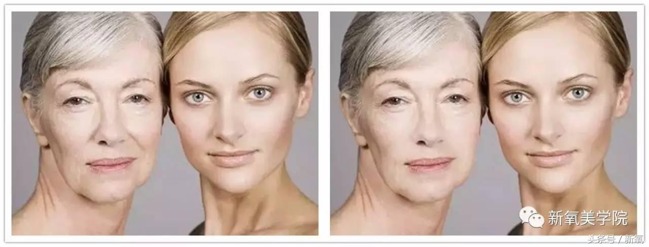 小s脸肿原因,小s脸怎么越来越肿