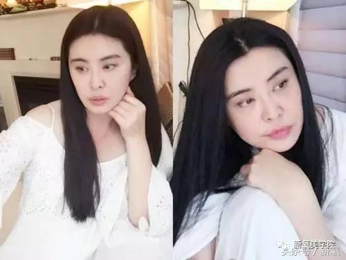 小s脸肿原因,小s脸怎么越来越肿