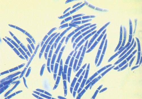 植物发黑腐烂，如何快速营救？黑腐病症状及解决方法！