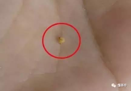 好的陈皮会有虫子吗,陈皮容易生虫子怎么办