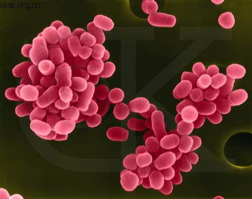 食用未全熟羊肉染上布氏杆菌病,吃熟羊肉会感染布病吗