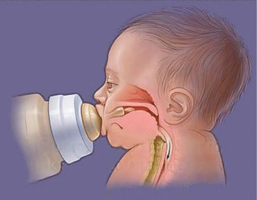 孩子口部肌肉训练,孩子不说话口肌训练有用吗