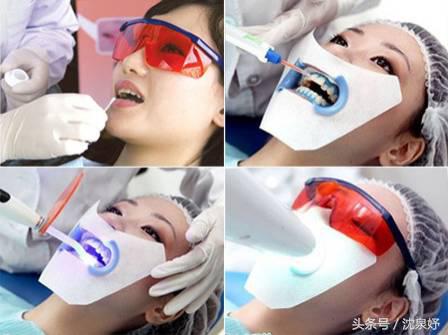 每天刷牙牙齿还黄?学会这些是美白牙齿的关键