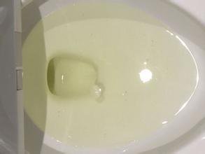 尿泡多就一定是蛋白尿吗,一泡尿从黄到清正常吗