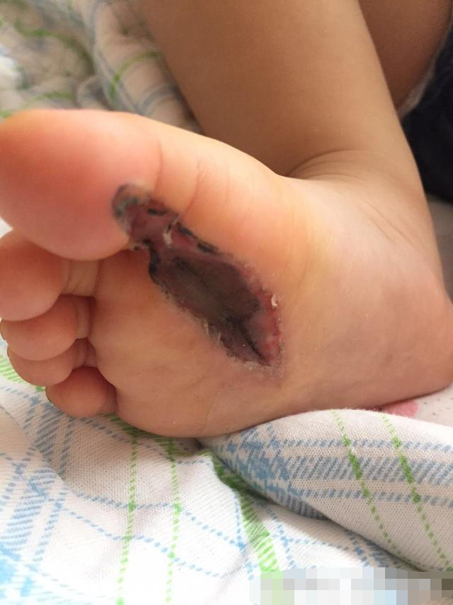 家有宝宝的时刻注意孩子的牙齿,家有宝宝的家长请注意