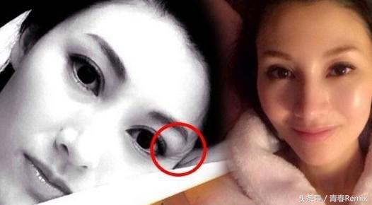 眼睛保养的最佳方法,眼睛如何保养年轻