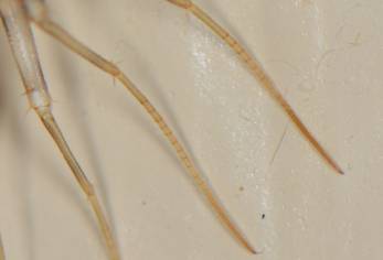 市民在鹅卵石地面做热疗,市民躺鹅卵石