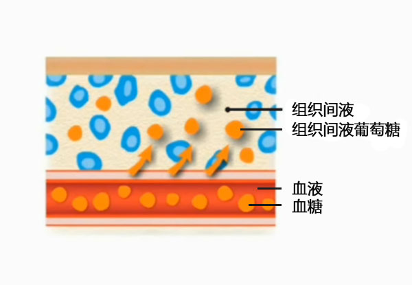 雅培瞬感血糖多久最准确,雅培动态血糖结果解读