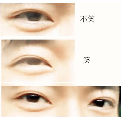 常见眼型自测,常见眼型