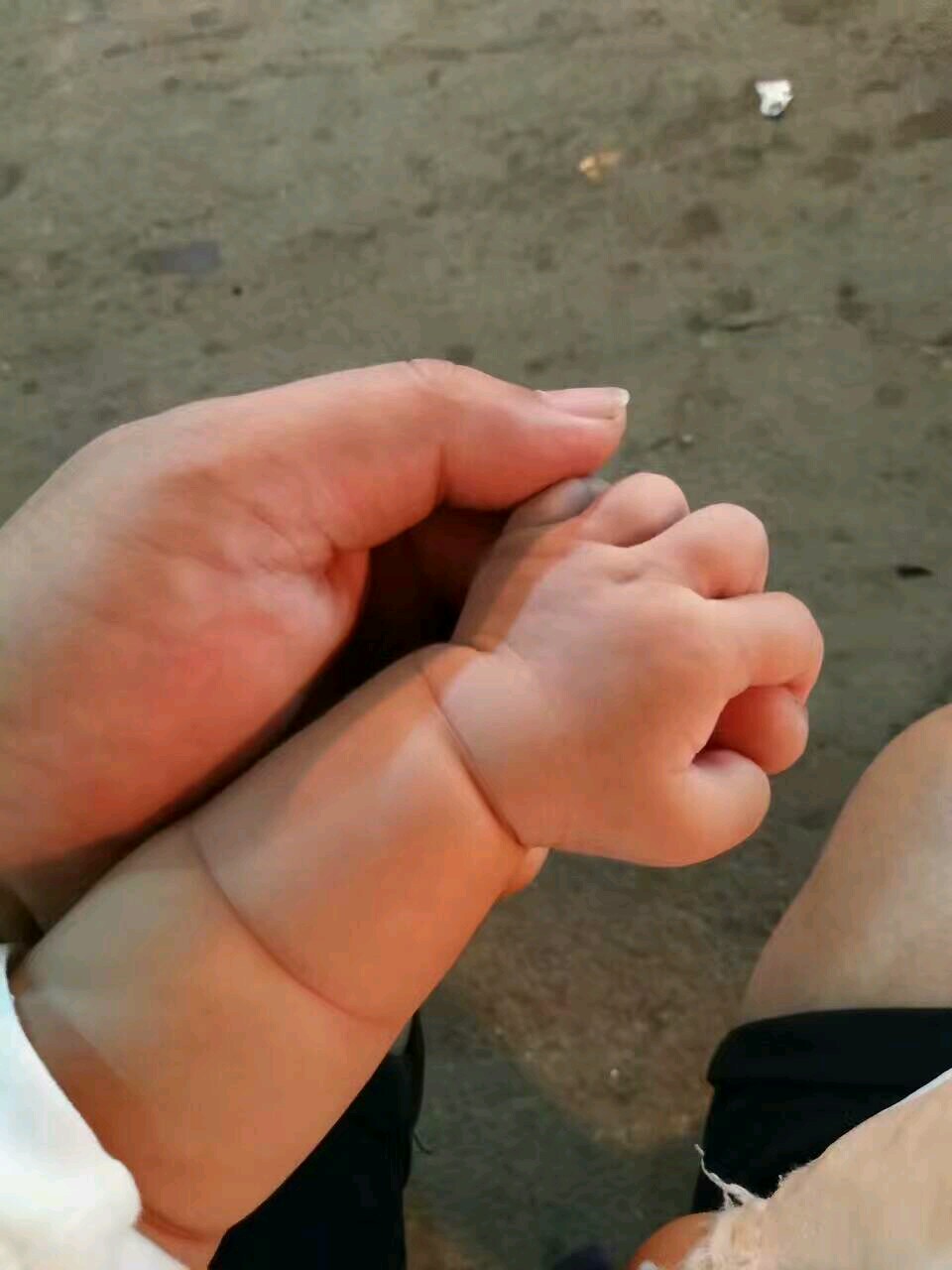 马蹄足内翻宝宝康复记,给相同经历的宝妈一些正能量