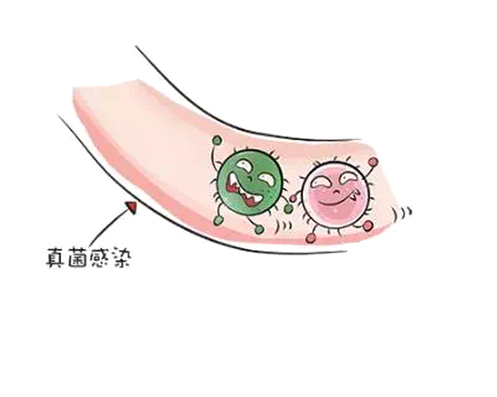 宝贝耳朵有耳屎要不要掏出来呢,宝贝耳朵有耳屎不让弄怎么办